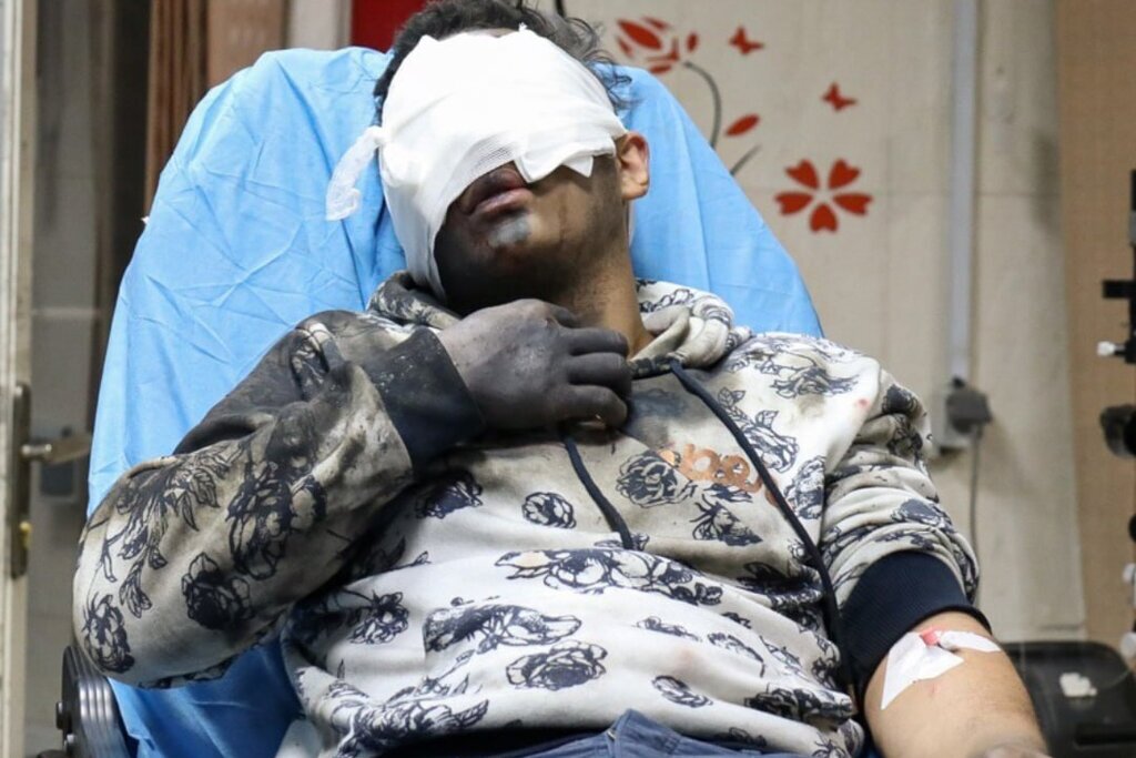 چهارشنبه سوری شروع نشده ۵ قربانی گرفت / ۱۵ نفر قطع عضو شدند