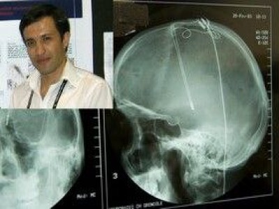 با کمک یک نخبه ی بهاری: گامی جدید در جهت درمان بیماری پارکینسون برداشته شد